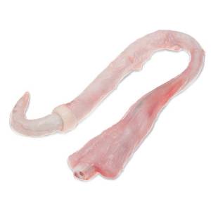 Penis